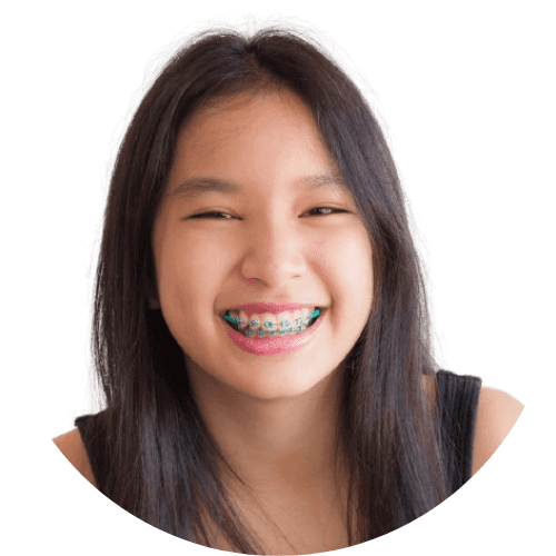 braces